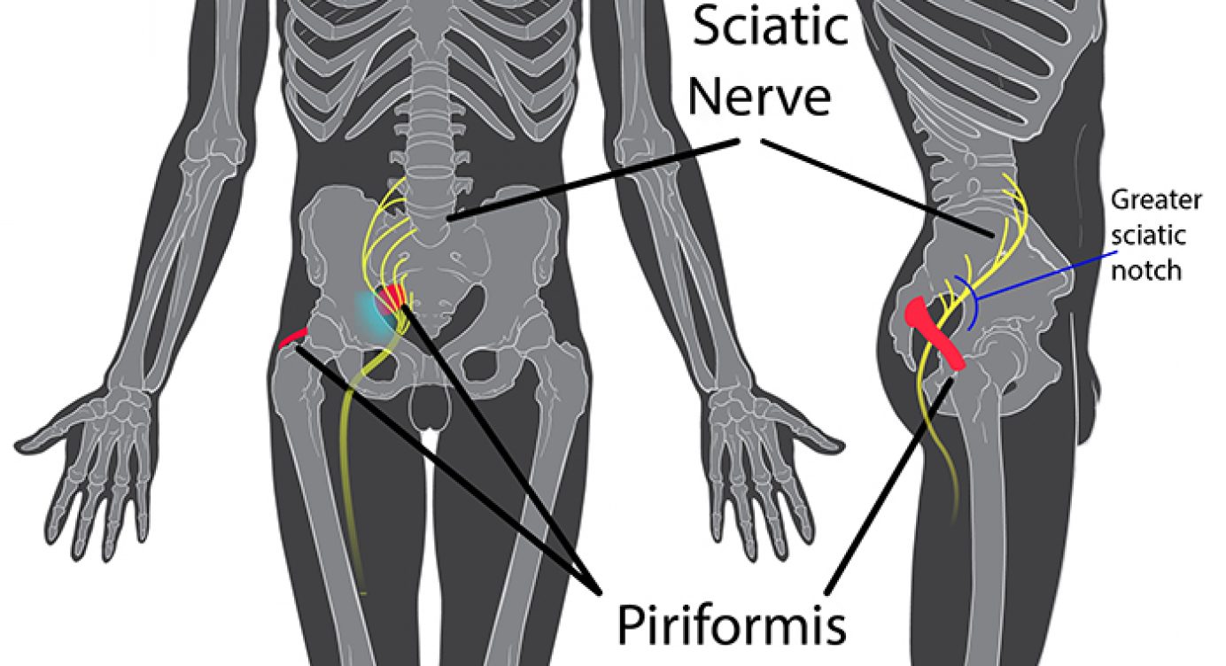 Suprapiriform Foramen