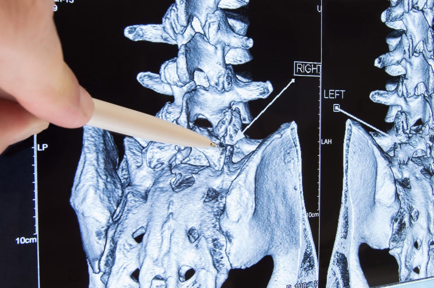 chiropractor lumbosacral-spine x ray el paso tx