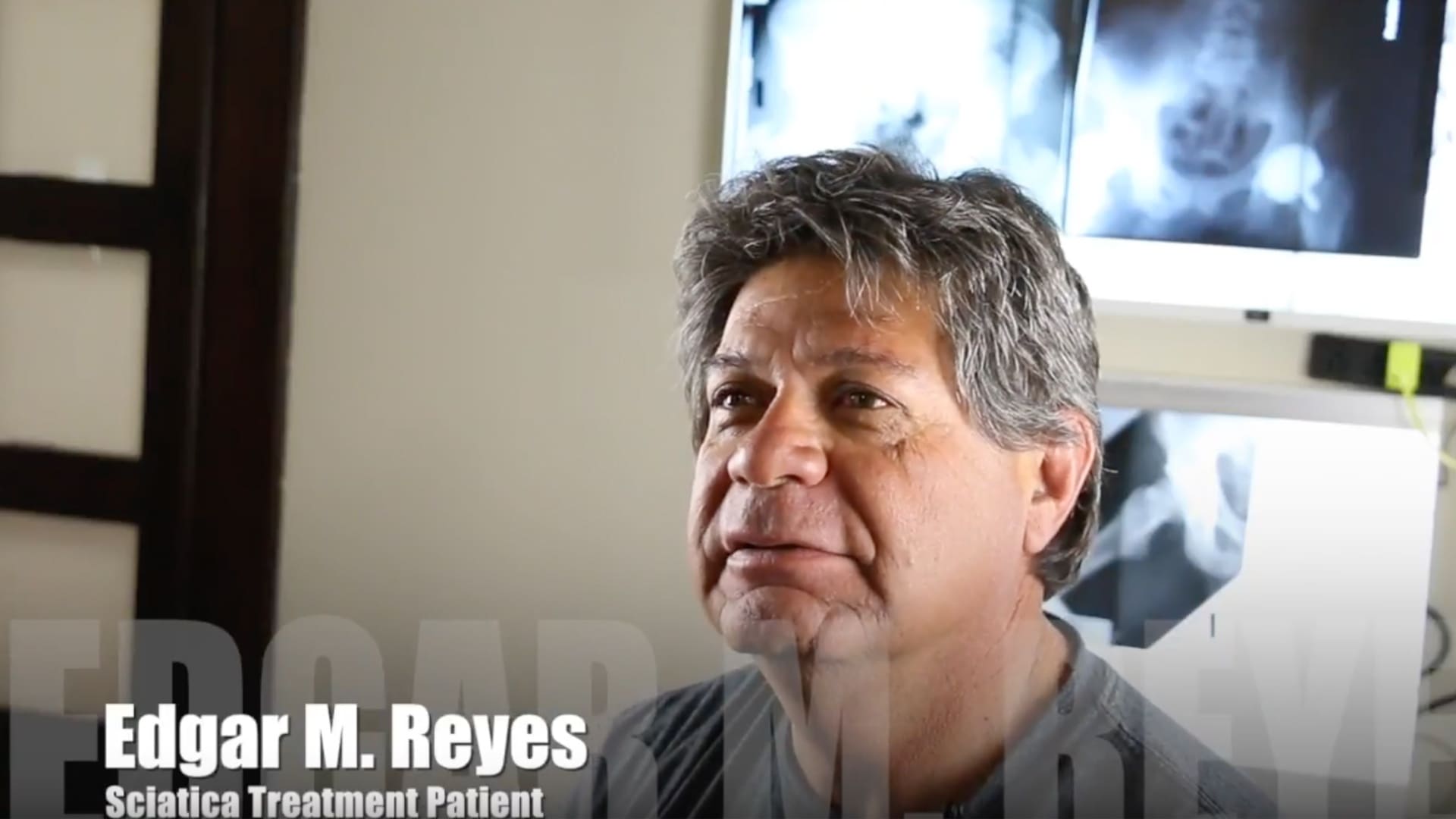 Tratamiento del dolor nervioso ciática El Paso, TX | Edgar M. Reyes